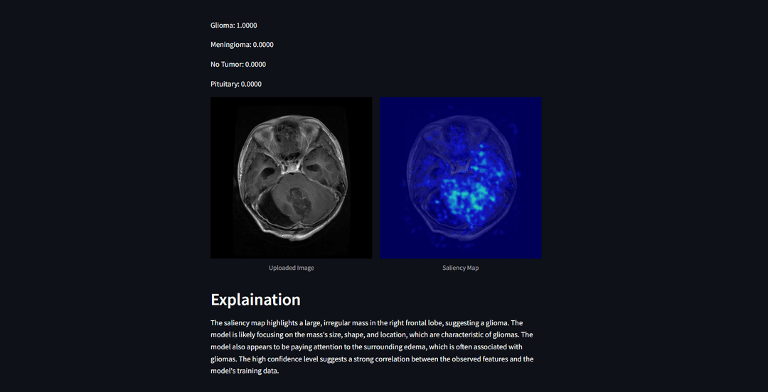 Brain Tumor MRI Classification